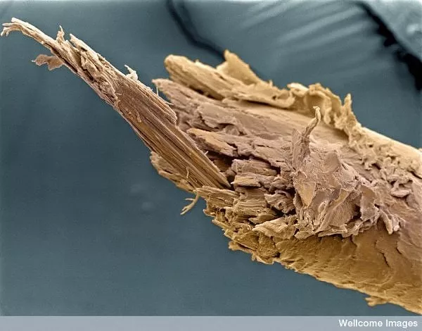 Polomljena vlas kose slike Elektronskog mikroskopa Polomljena vlas kose slike Elektronskog mikroskopa