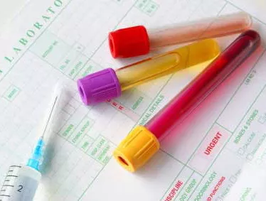 Test krvi krv autoimmune bolesti Blood Test Results Test krvi krv autoimmune bolesti Blood Test Results