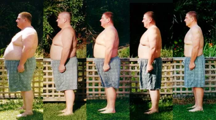 Šta je insulinska rezistencija - veza dijabetes i gojaznost Šta je insulinska rezistencija - veza dijabetes i gojaznost