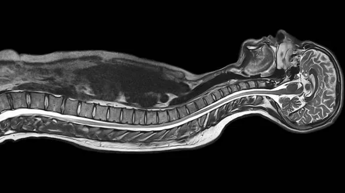 Magnetna rezonanca - ko je izmislio magnetnu rezonancu MRI