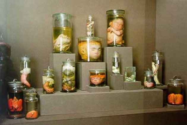 Kunstkamera Petrovgrad izložba ljudskih tela i organa