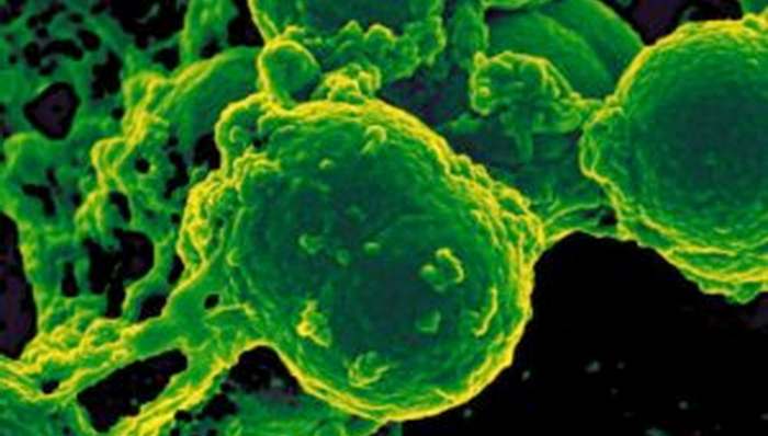 Super bakterija MRSA i novi antibiotik Super bakterija MRSA i novi antibiotik