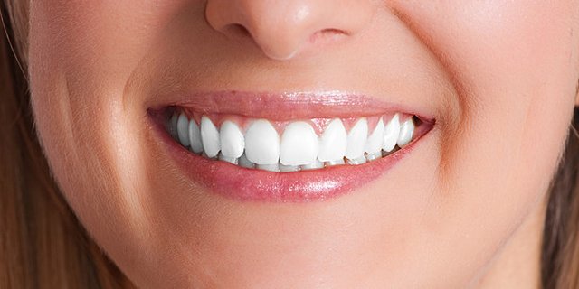 Zubni implant