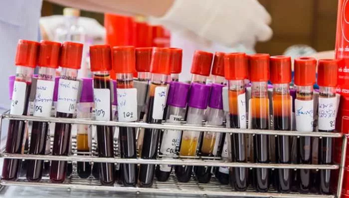 Krvna grupa i evolucija - Zašto imamo krvne grupe Krvna grupa i evolucija - Zašto imamo krvne grupe