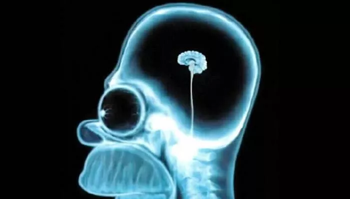 Mali mozak i izopačeni vrednosni ambijent Mali mozak i izopačeni vrednosni ambijent