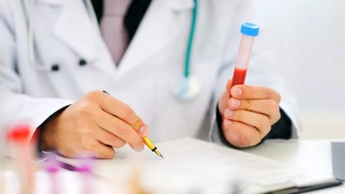 smanjiti nivo kalijuma