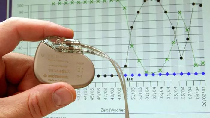 hakovanje pejsmejkera