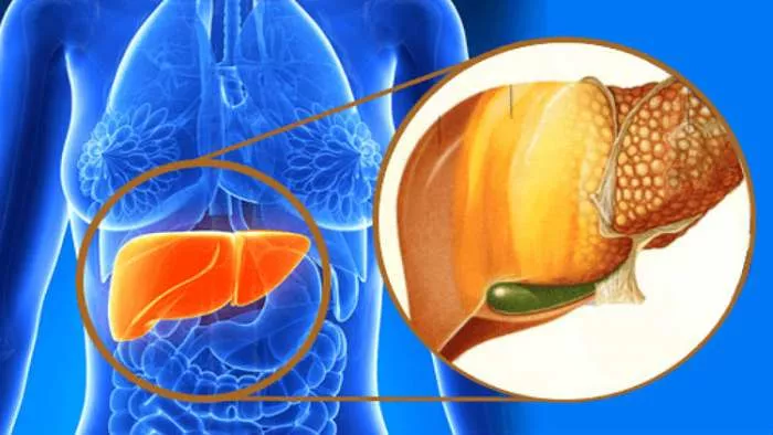 lečenje masne jetre