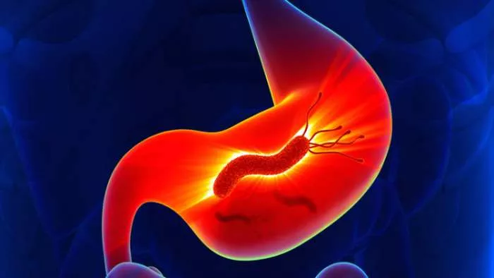 lečenje helikobakterije