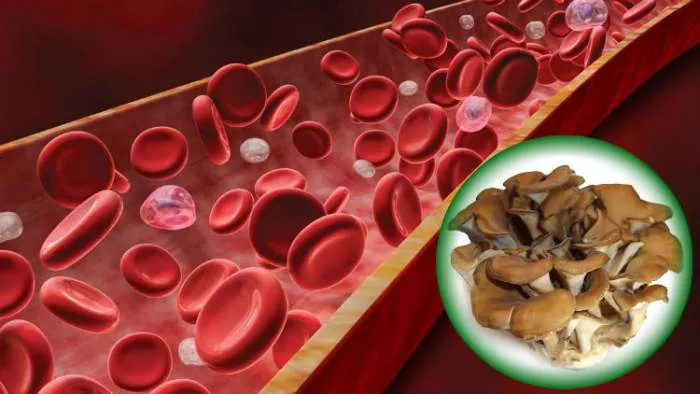 mijelodisplastični sindrom