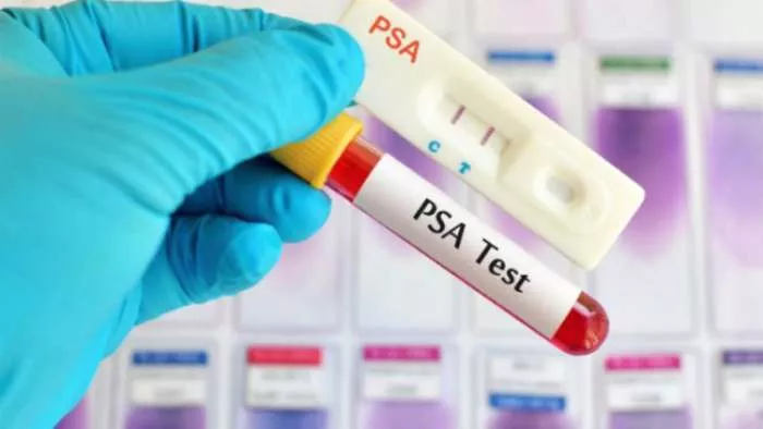 psa test