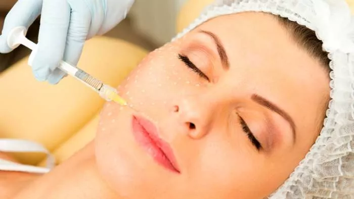 hijaluronski fileri