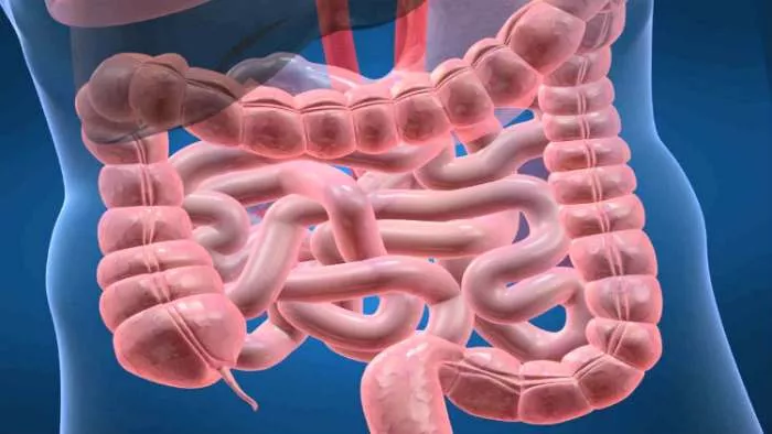 sindrom propustljivog creva