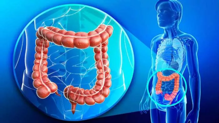 simptomi raka debelog creva