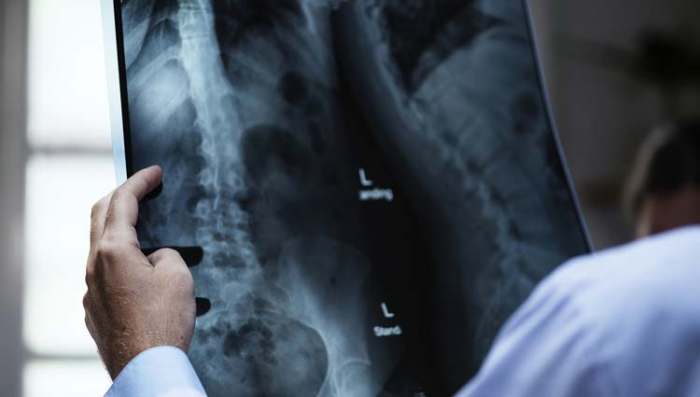 doktor gleda snimke kostiju