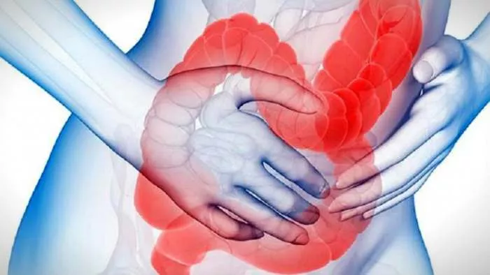 simptomi iritabilnog kolona