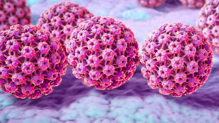HPV virus i šta su analni kondilomi virusne bradavice i kako se leči kondilom CONDYLOMATA ACCUMINATA