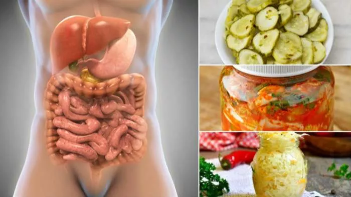 probiotici i multipla skleroza