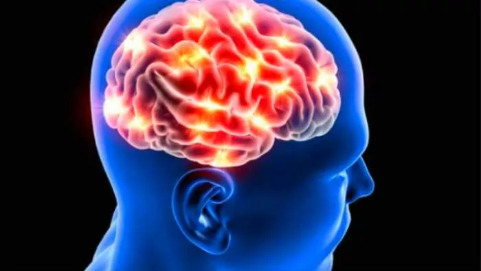 srednja moždana arterija