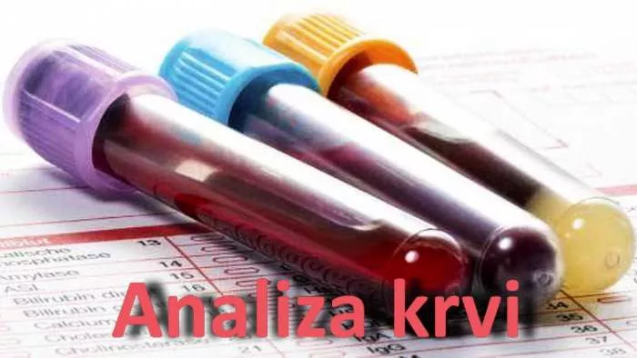 Šta je Normalna krvna slika - KSS kompletna krvna slika Šta je Normalna krvna slika - KSS kompletna krvna slika