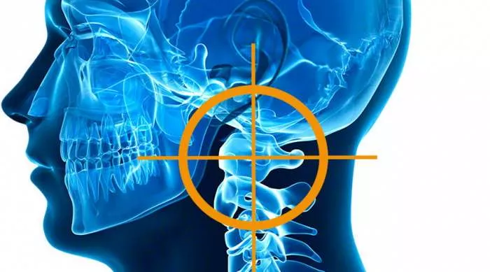 Nameštanje Atlasa - Zašto se namešta Atlas pršljen na vratu Nameštanje Atlasa - Zašto se namešta Atlas pršljen na vratu