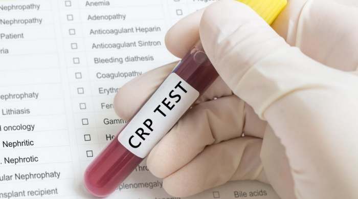 Šta je CRP marker inflamacije (upale) u telu test krvi