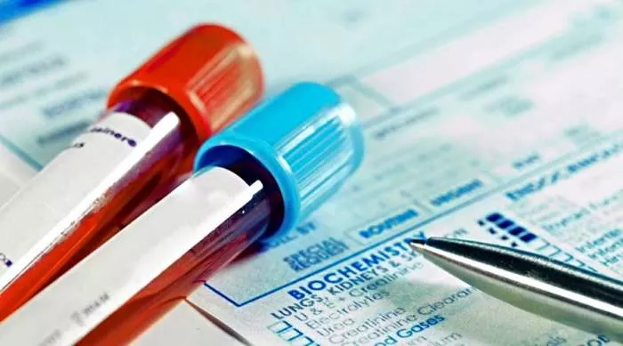 normalni nivo amonijaka