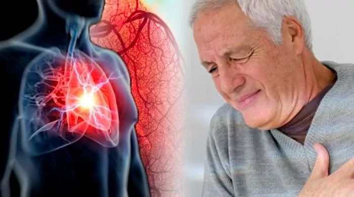 simptomi lupanja srca