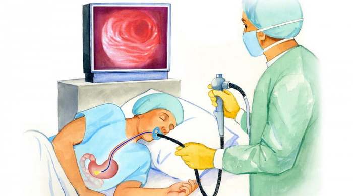  ta Je Gastroskopija Kao Metoda Pregleda eluca I Ko Ide Na Gastroskopiju