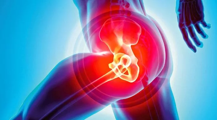 rizik od preloma kuka