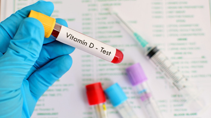 nizak nivo vitamina d