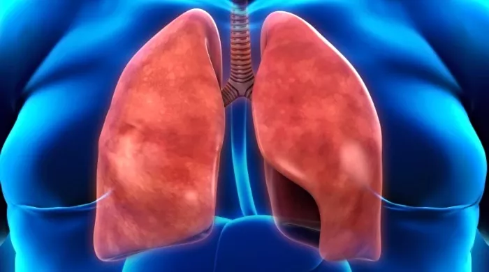 masnoća u plućima