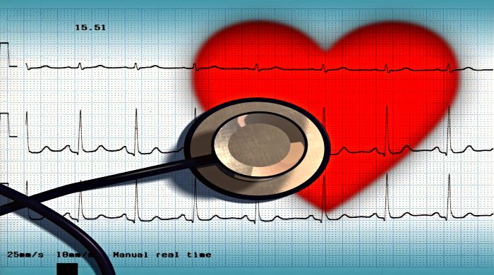 ekg analiza