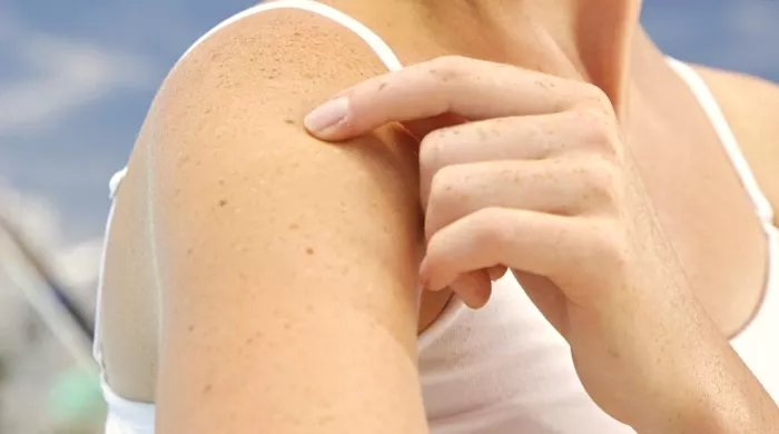 simptomi insulinske rezistencije