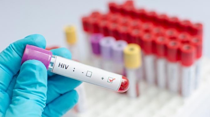 izlečen hiv