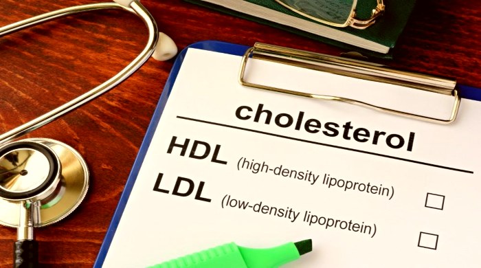 dobar holesterol