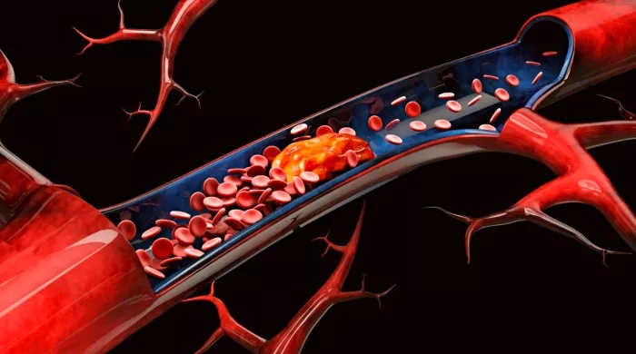 holesterol u detinjstvu