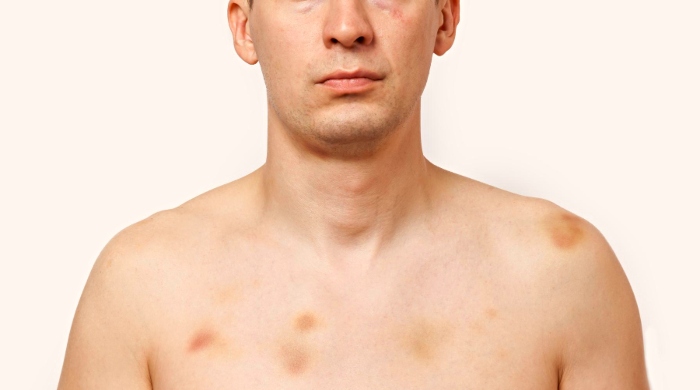 modrice telu