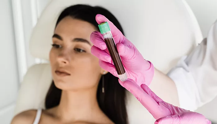 PRP tretman ili Vampirski tretman lica - da li je bezbedan