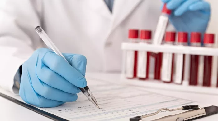 vrednosti holesterola